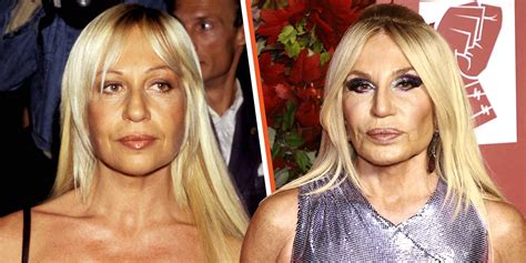 donatella versace original face|Donatella Versace today images.